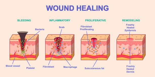 Poorly Healing Wounds